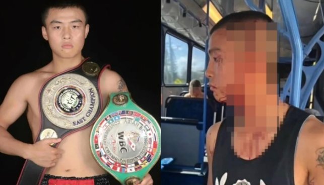 Chu Nhuận Kỳ bị tấn công trên xe buýt